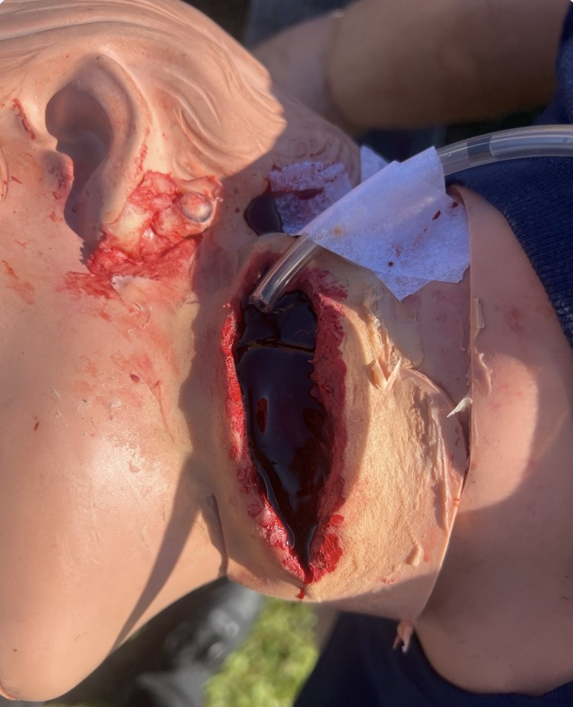 Wax neck wound with blood pump attached