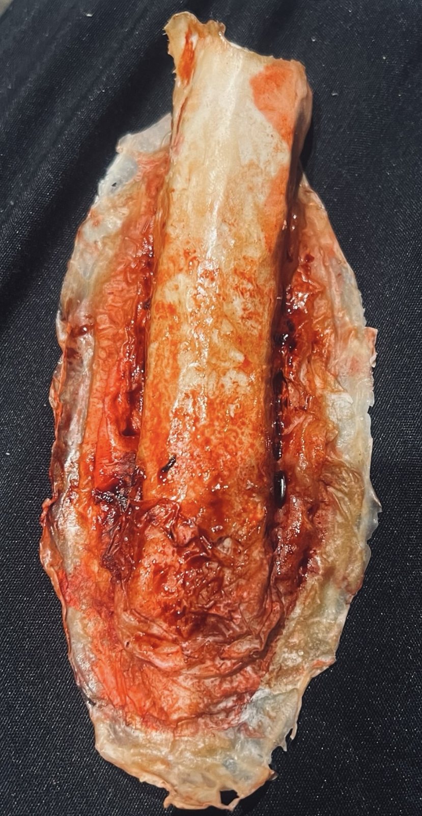 Open compound fracture prosthetic made from silicone